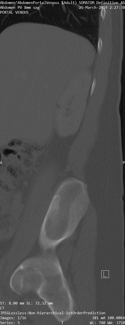 Series 005 image 1