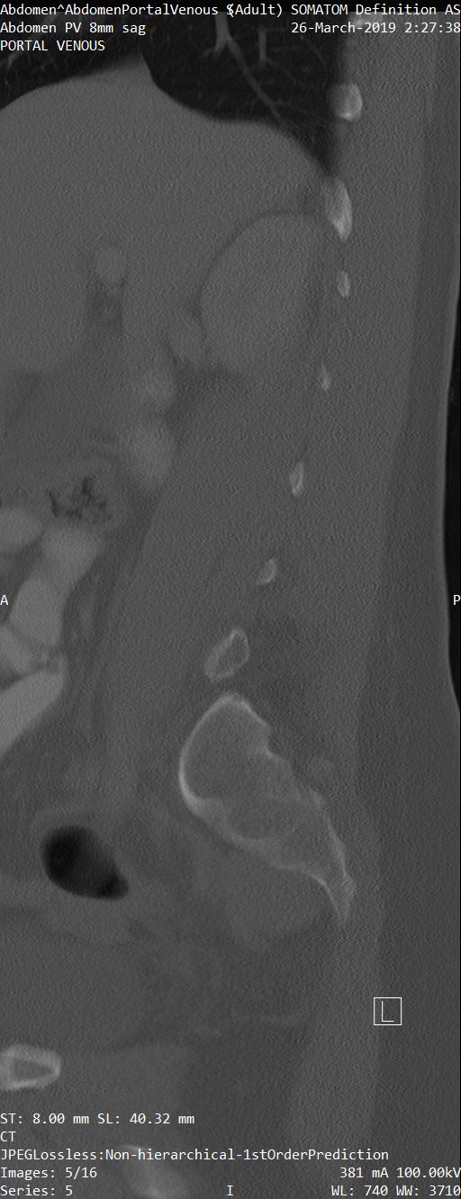 Series 005 image 5
