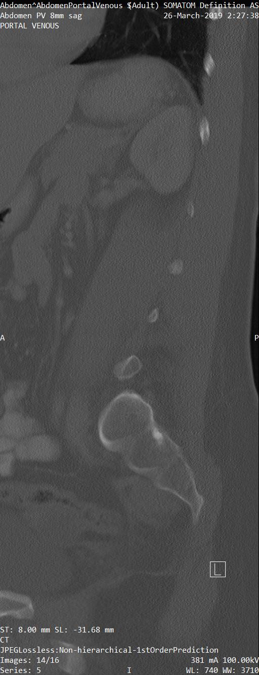 Series 005 image 14
