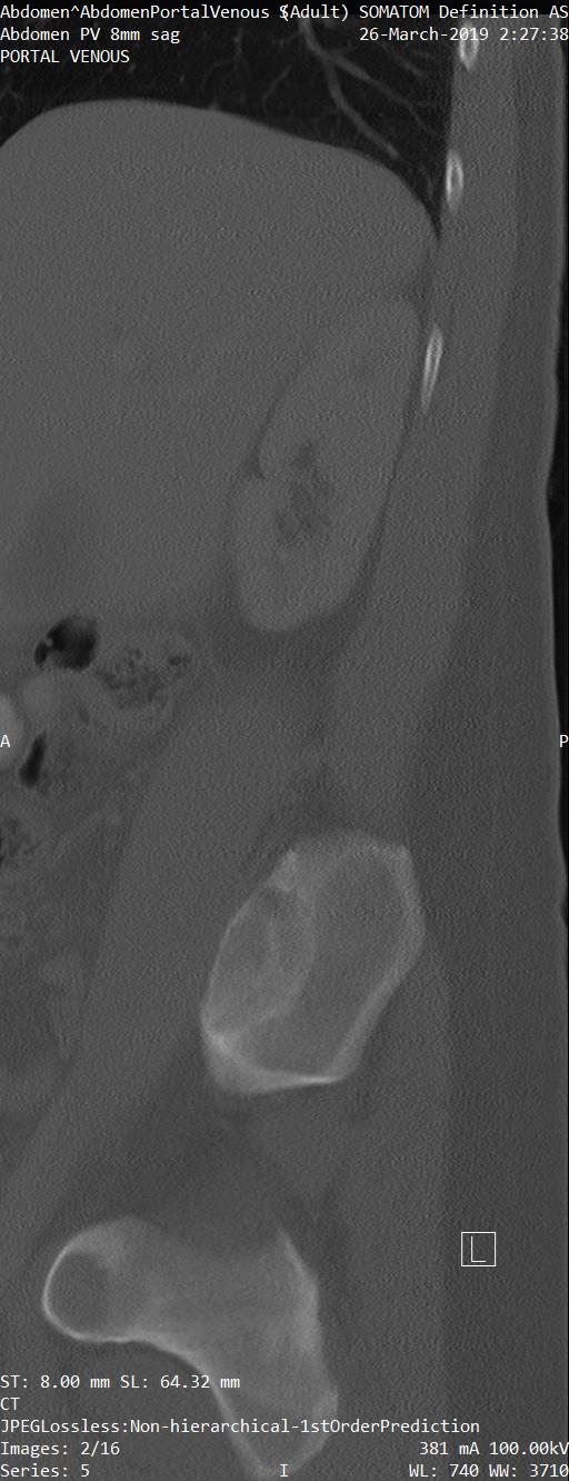 Series 005 image 2