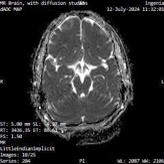 Series 204 image 10