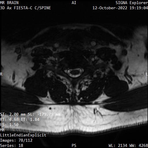 Series 018 image 78