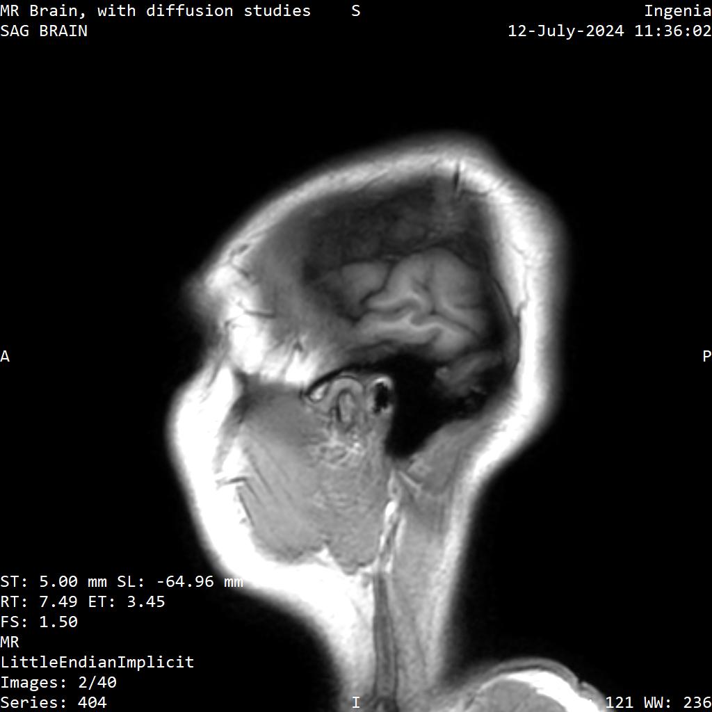 Series 404 image 2