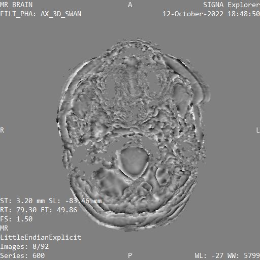 Series 600 image 8