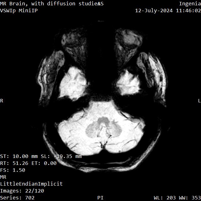 Series 702 image 22