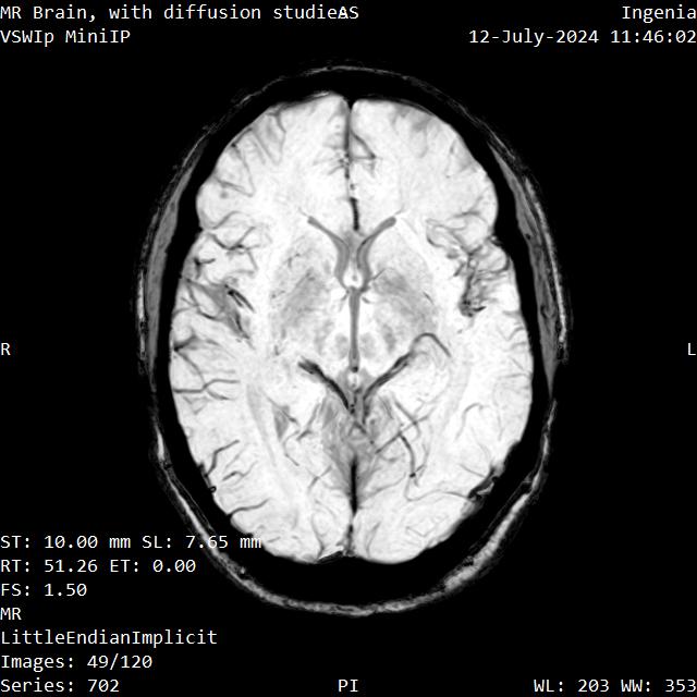 Series 702 image 49