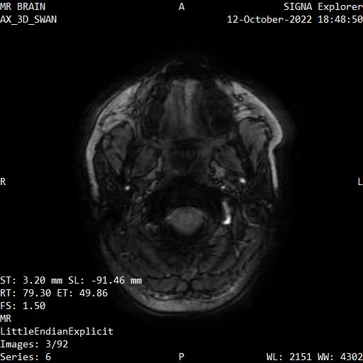 Series 006 image 3
