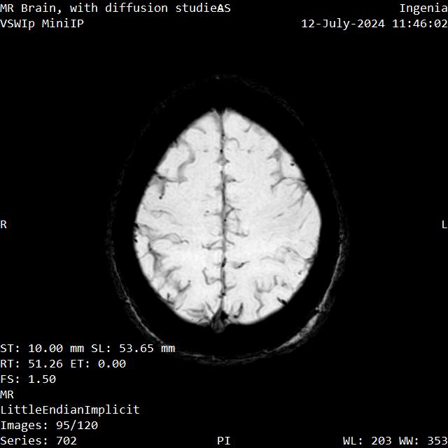 Series 702 image 95