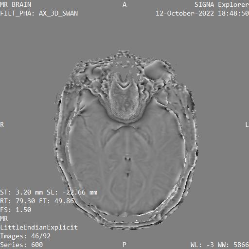 Series 600 image 46