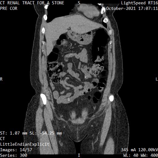 Series 300 image 14