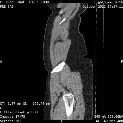 Series 301 image 17
