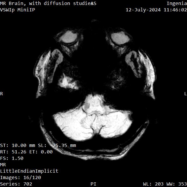 Series 702 image 16