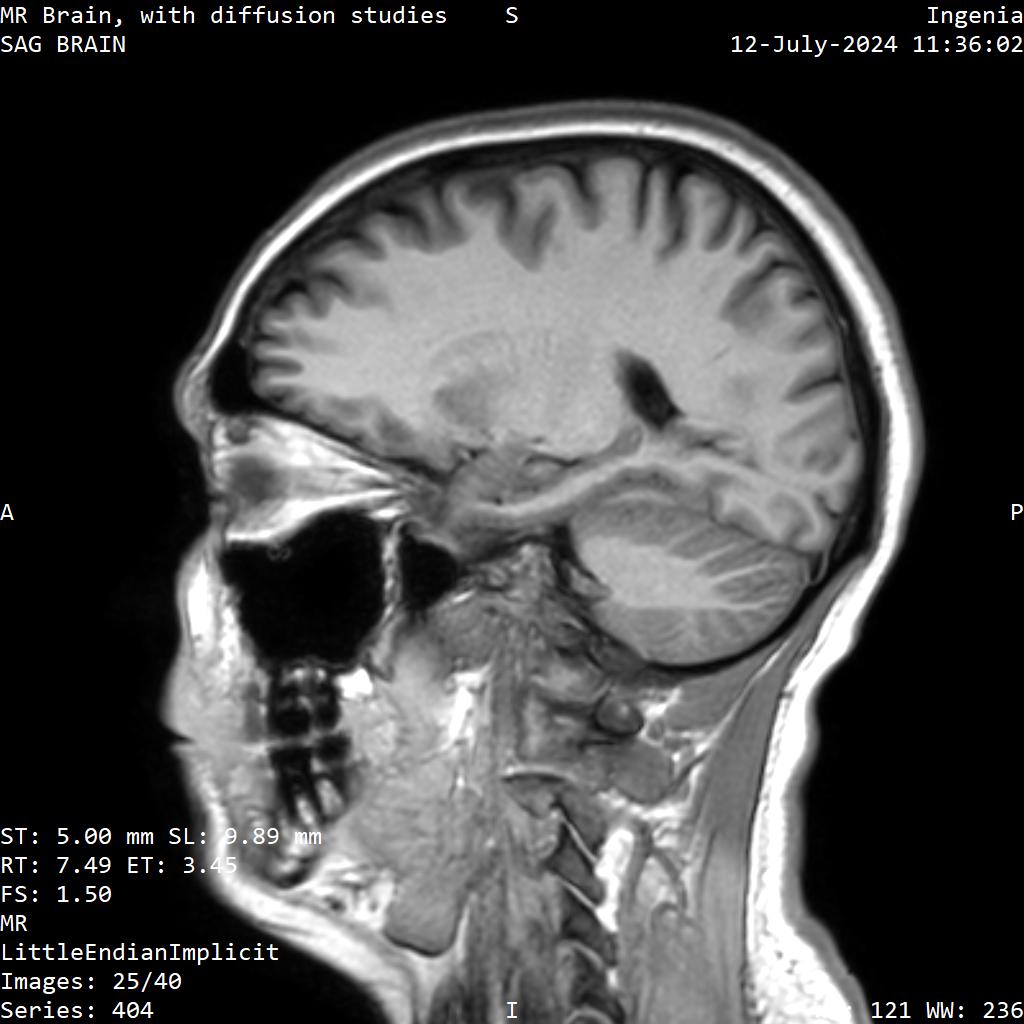 Series 404 image 25