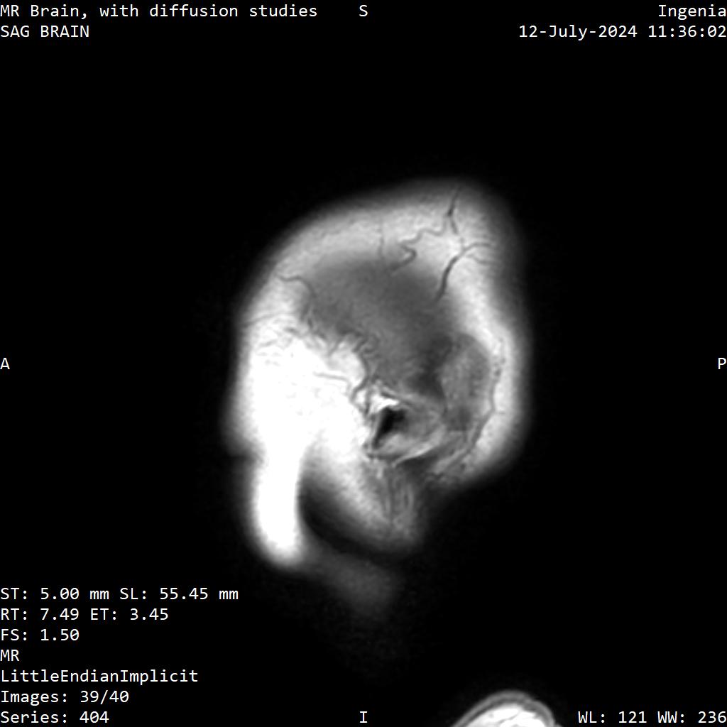 Series 404 image 39