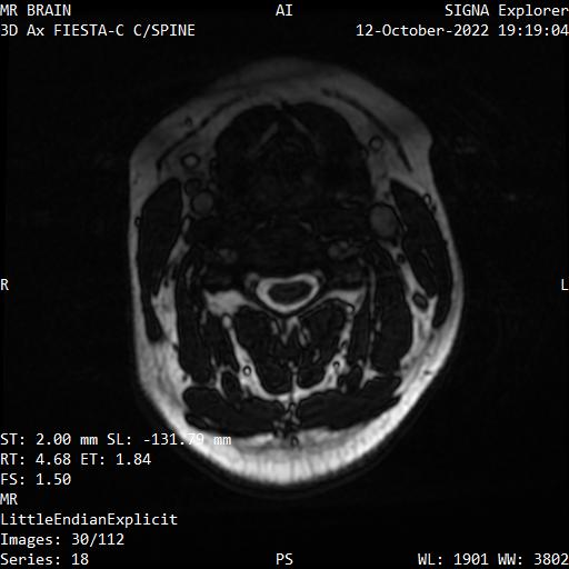 Series 018 image 30
