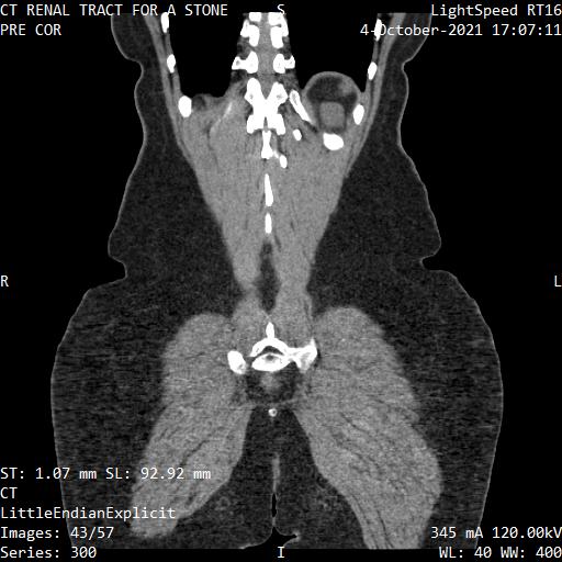 Series 300 image 43