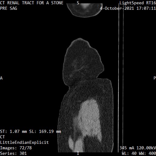 Series 301 image 72