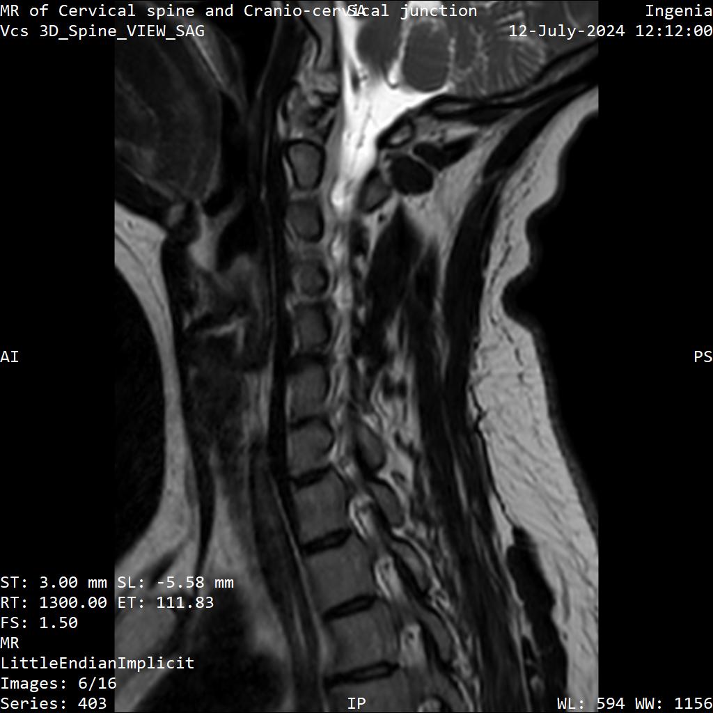 Series 403 image 6