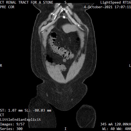 Series 300 image 9