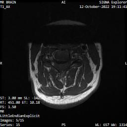 Series 015 image 5