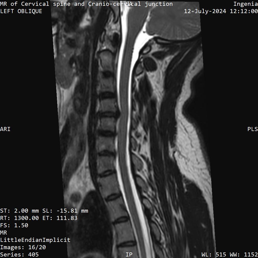 Series 405 image 16