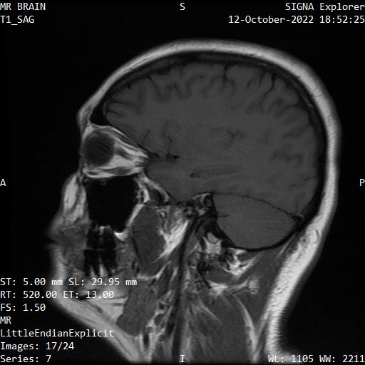 Series 007 image 17