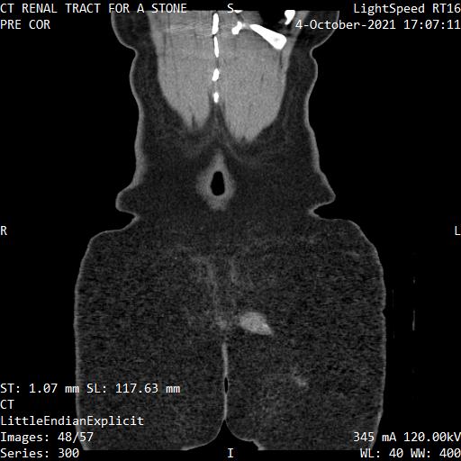 Series 300 image 48