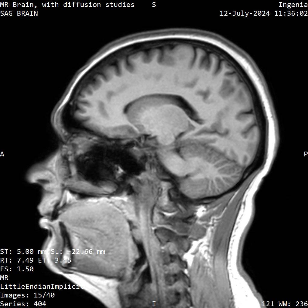 Series 404 image 15