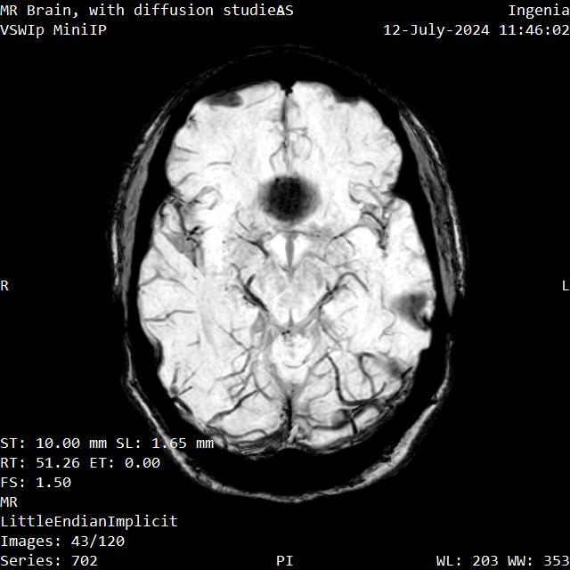Series 702 image 43