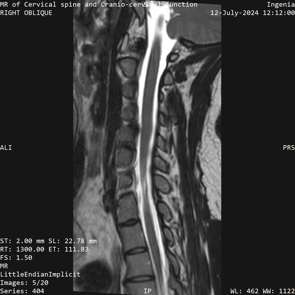 Series 404 image 5