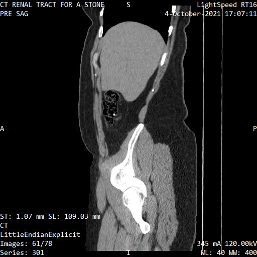 Series 301 image 61