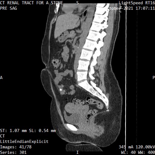 Series 301 image 41