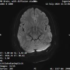 Series 203 image 11