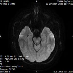 Series 005 image 12