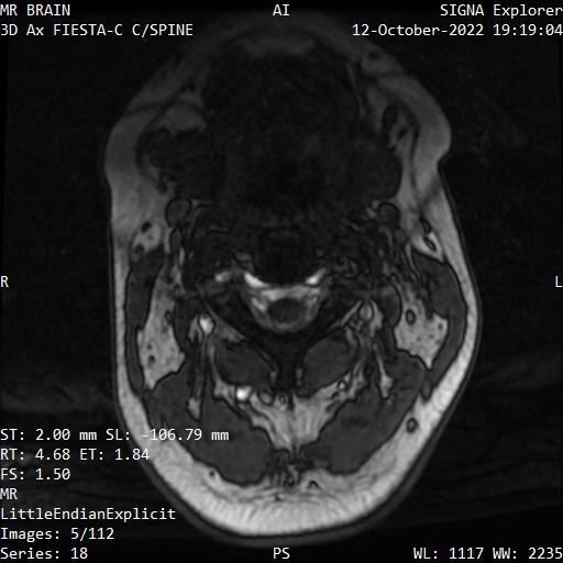 Series 018 image 5
