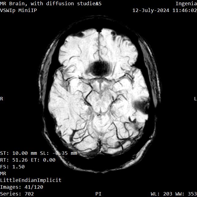 Series 702 image 41