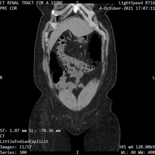 Series 300 image 11