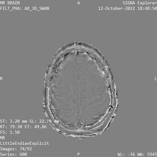 Series 600 image 74