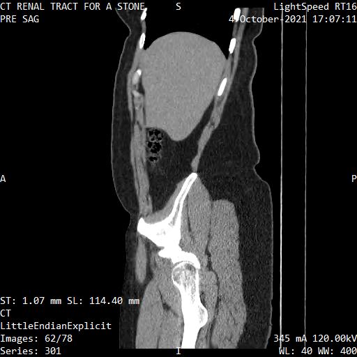 Series 301 image 62