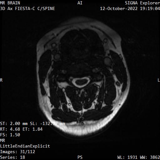 Series 018 image 31