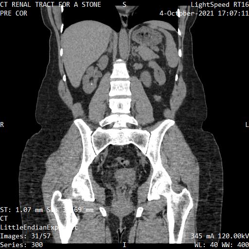 Series 300 image 31