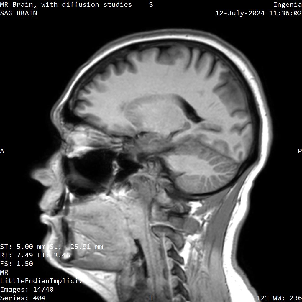 Series 404 image 14
