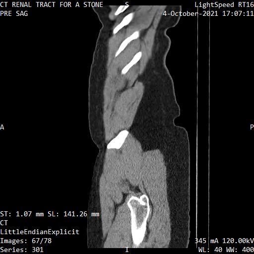 Series 301 image 67