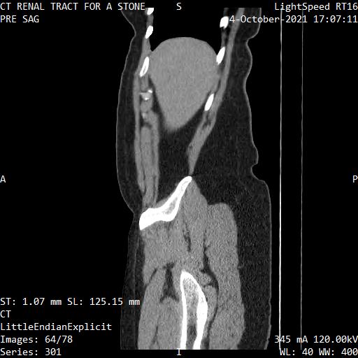Series 301 image 64