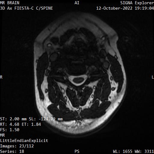 Series 018 image 23