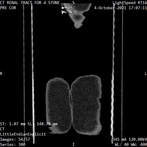 Series 300 image 54