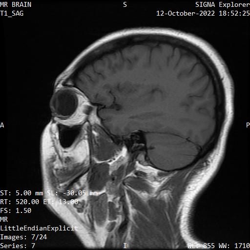 Series 007 image 7