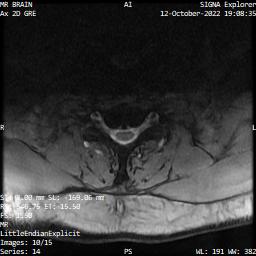 Series 014 image 10