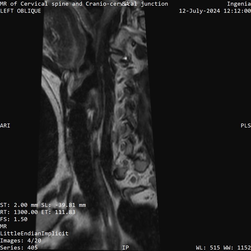 Series 405 image 4