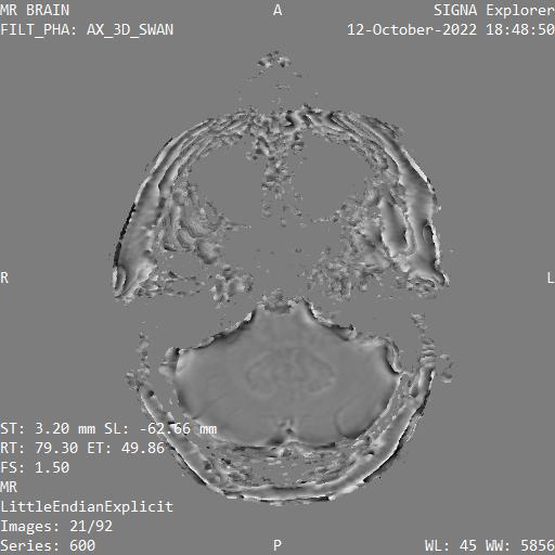Series 600 image 21